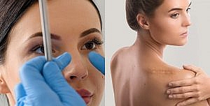 Chirurgie cosmetica, chirurgie plastica - Care este diferenta?