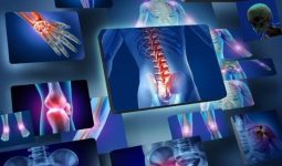 Sistemul Locomotor: Structură, Funcție și Boli Specifice